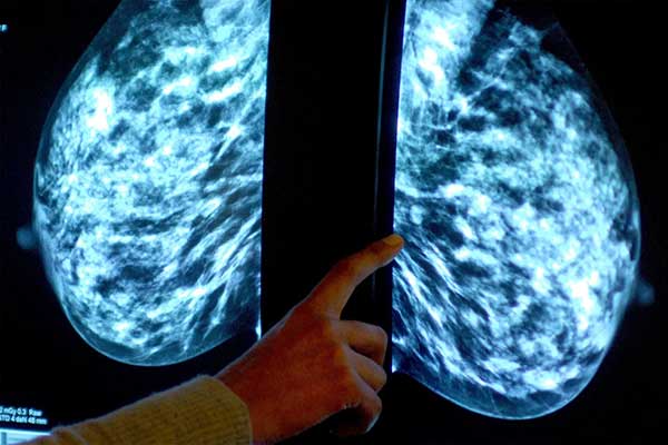 New AI Architecture Can Detect Breast Cancer With a Near-Perfect Accuracy Rate