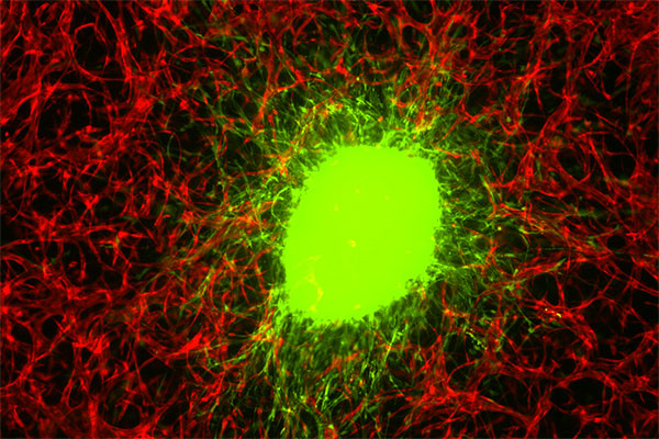 Glioblastoma stem cells